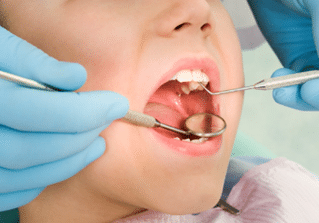 A child with mouth wide open during a dental examination.